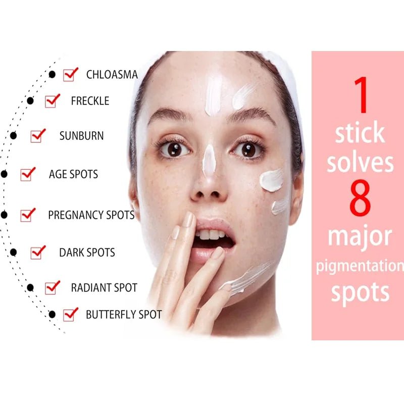 Whitening Freckle Cream Effectively reduces dark spots Brightens and revitalizes dull skin Hydrates and nourishes the skin - Bakka shop