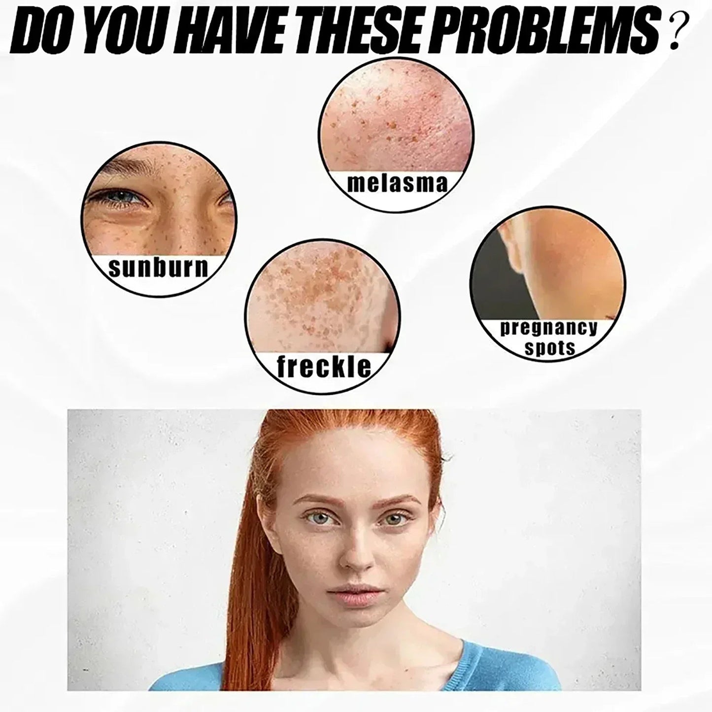 Whitening Freckle Cream Effectively reduces dark spots Brightens and revitalizes dull skin Hydrates and nourishes the skin - Bakka shop