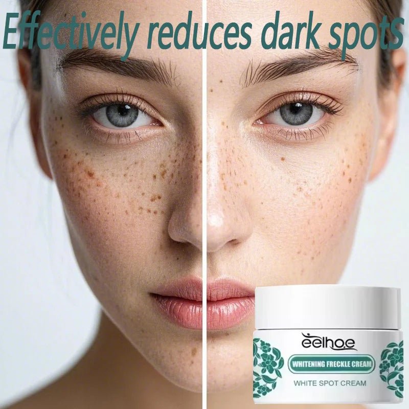 Whitening Freckle Cream Effectively reduces dark spots Brightens and revitalizes dull skin Hydrates and nourishes the skin - Bakka shop