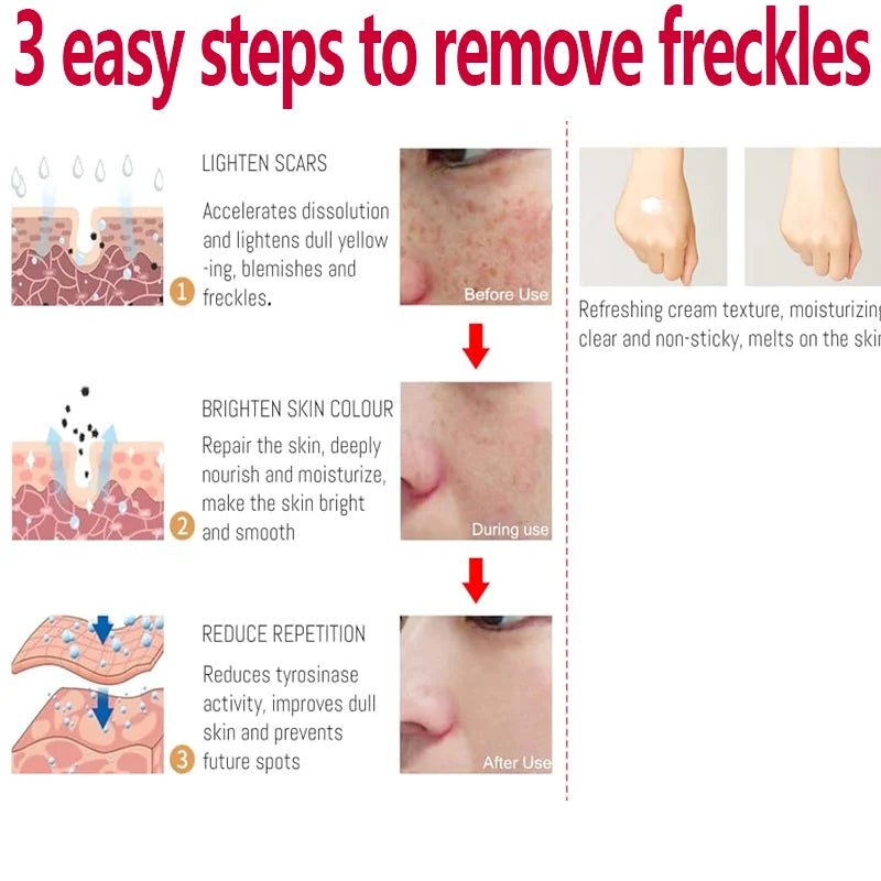 Whitening Freckle Cream Effectively reduces dark spots Brightens and revitalizes dull skin Hydrates and nourishes the skin - Bakka shop