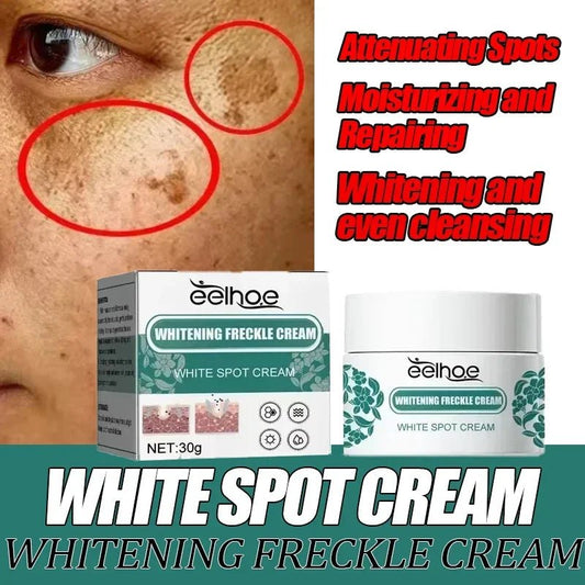 Eelhoe Niacinamide Melasma Brightening Cream Reduce Melanin Brighten Cream Lighten Dark Skin Chloasma Serum Skin Care Produce - Bakka shop