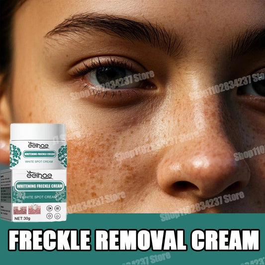 Freckle removal cream dilutes melanin and various spots on the face of sun spots and freckles. - Bakka shop