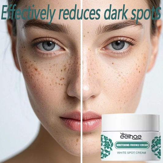 Whitening Freckle Cream Effectively reduces dark spots Brightens and revitalizes dull skin Hydrates and nourishes the skin - Bakka shop